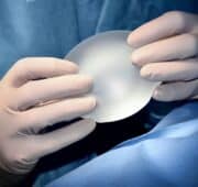 medical negligence - breast implants