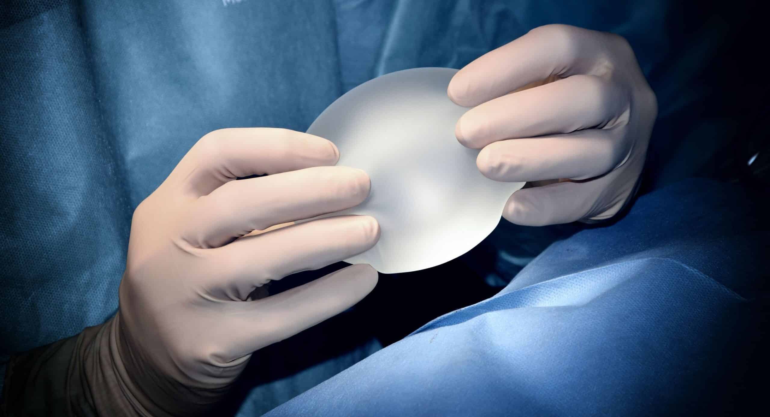 medical negligence - breast implants